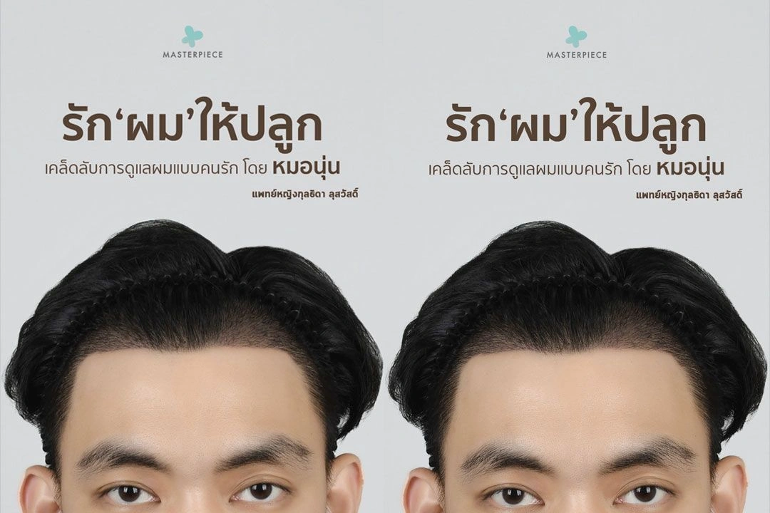 รัก 'ผม' ให้ปลูก