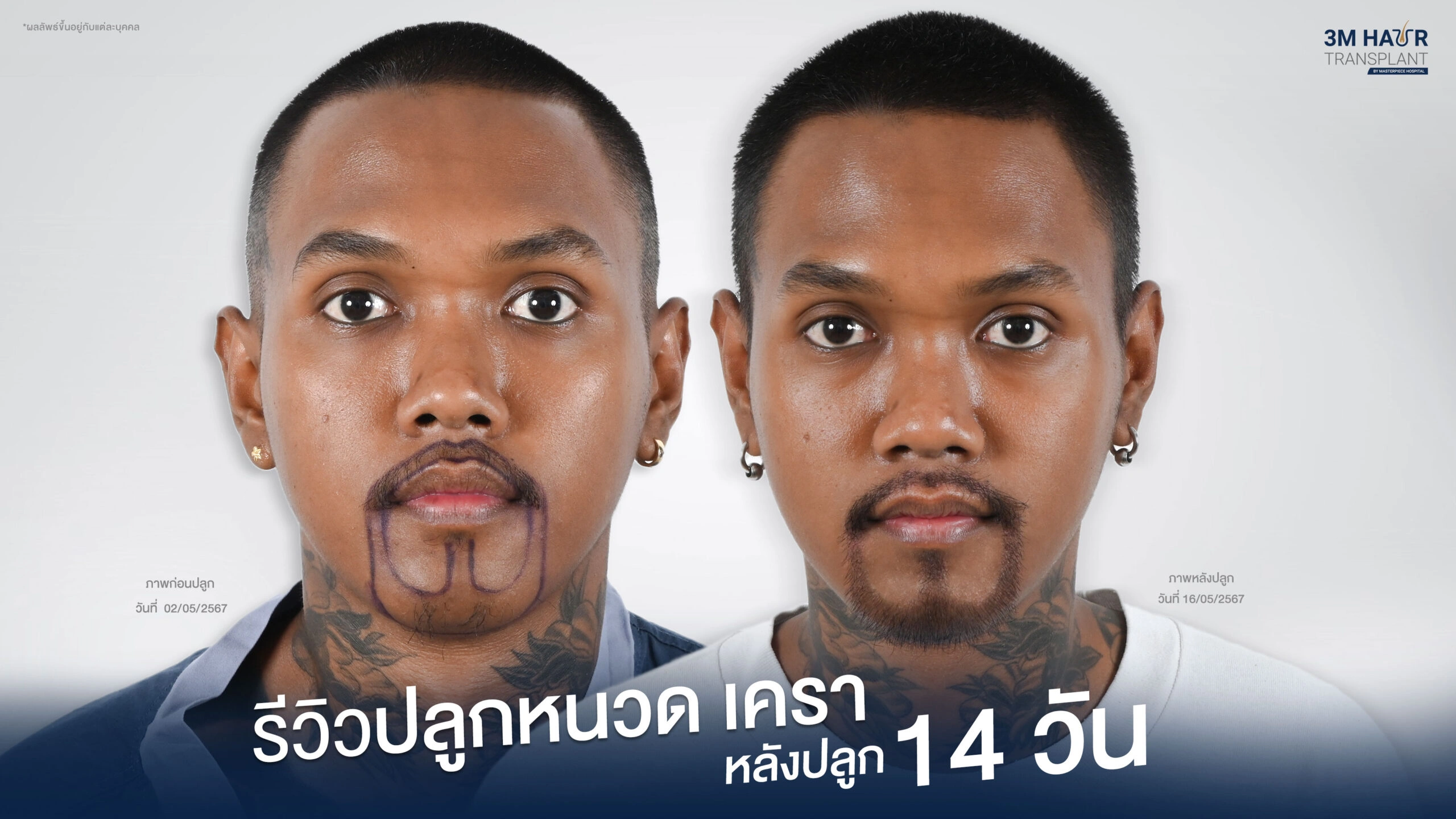 ปลูกหนวด เครา สไตล์แม็กซิกันแก็งค์