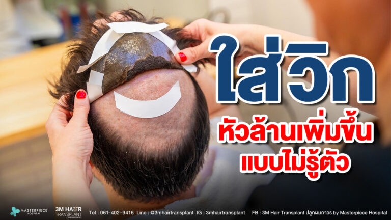 จากปกปิดสู่ปัญหา ใส่วิกนาน ๆ อาจทำให้หัวล้านเพิ่มขึ้นแบบไม่รู้ตัว