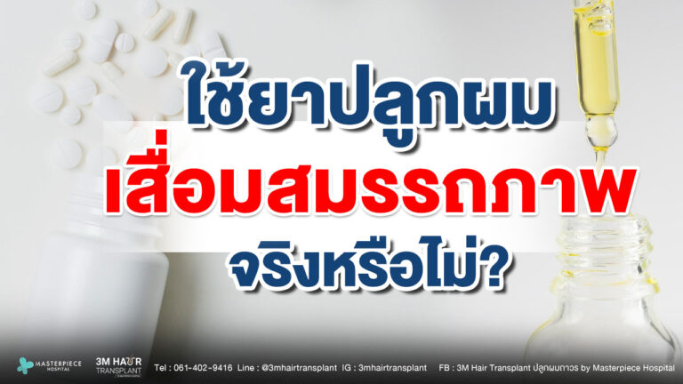 กินยาปลูกผมแล้วเสื่อมสมรรถภาพจริงไหม? ไขข้อสงสัยที่หลายคนกังวล