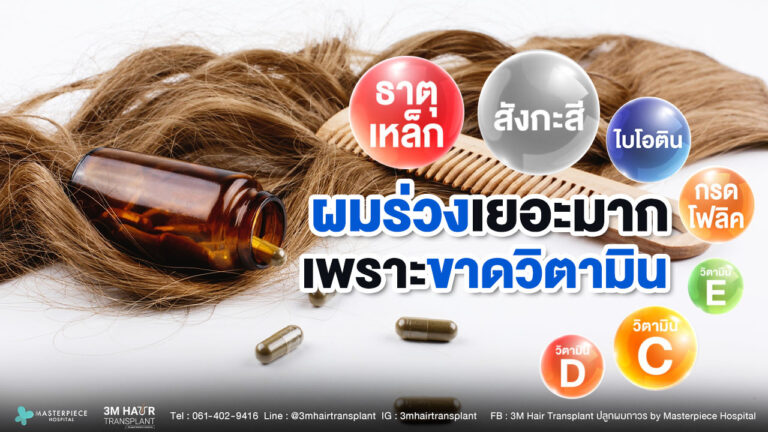 ผมร่วงเยอะมาก อาจเกิดจากการขาดวิตามินที่จำเป็น