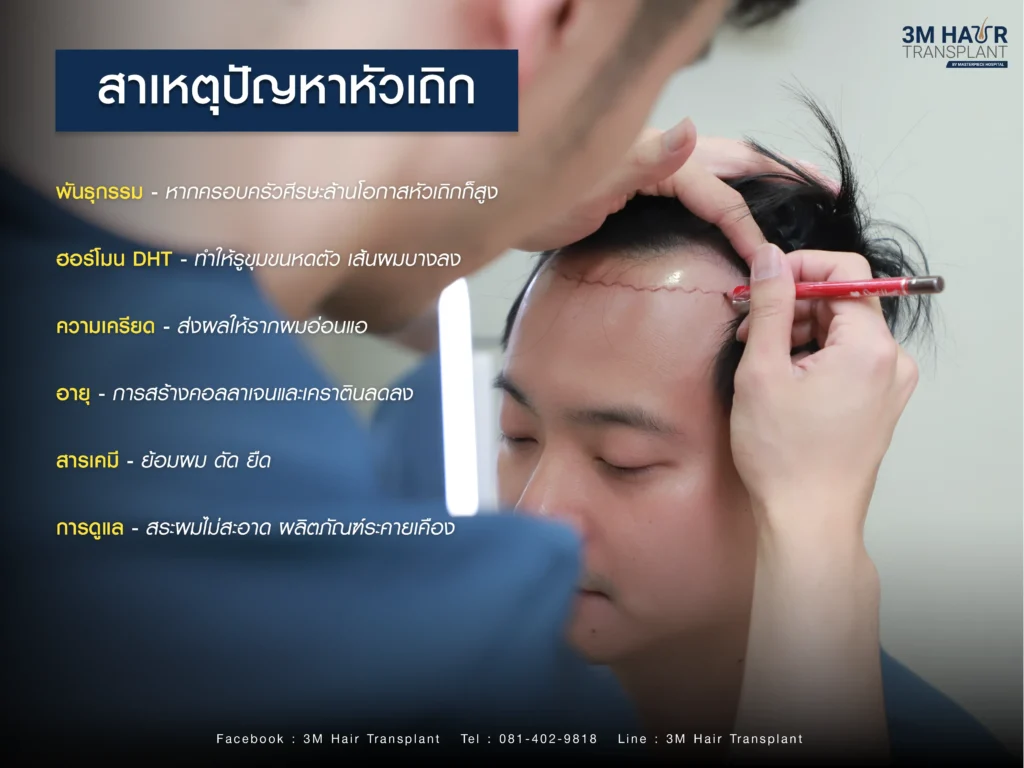 สาเหตุอะไรที่ส่งผลการเกิดปัญหาหัวเถิก