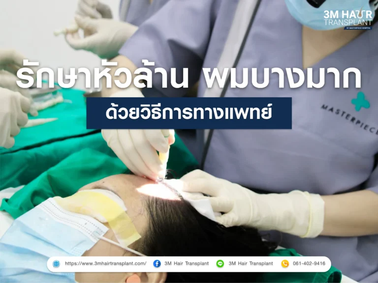 วิธีรักษาผู้หญิงหัวล้าน ผมบางมาก ทางการแพทย์