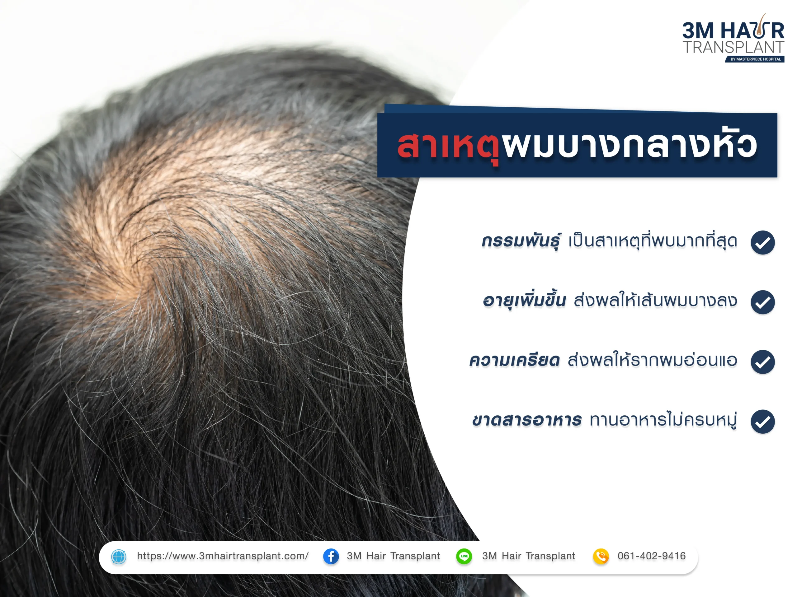 สาเหตุของผมบางกลางหัว หัวล้านไข่ดาว
