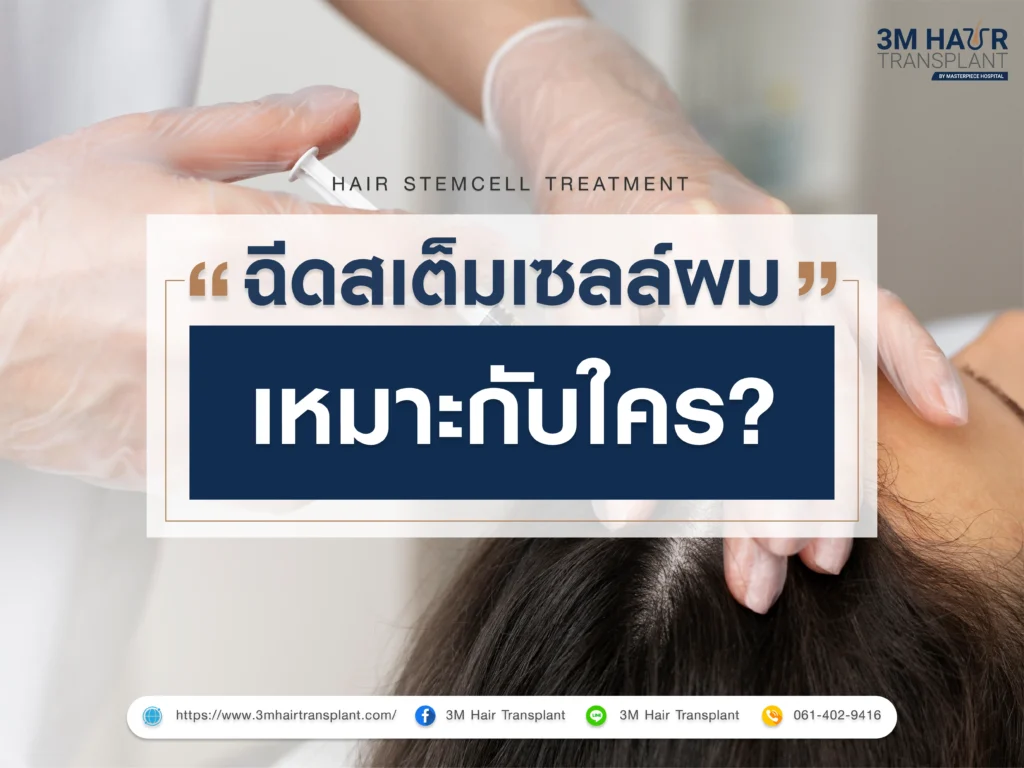 ใครที่เหมาะกับ ฉีดสเต็มเซลล์ผม