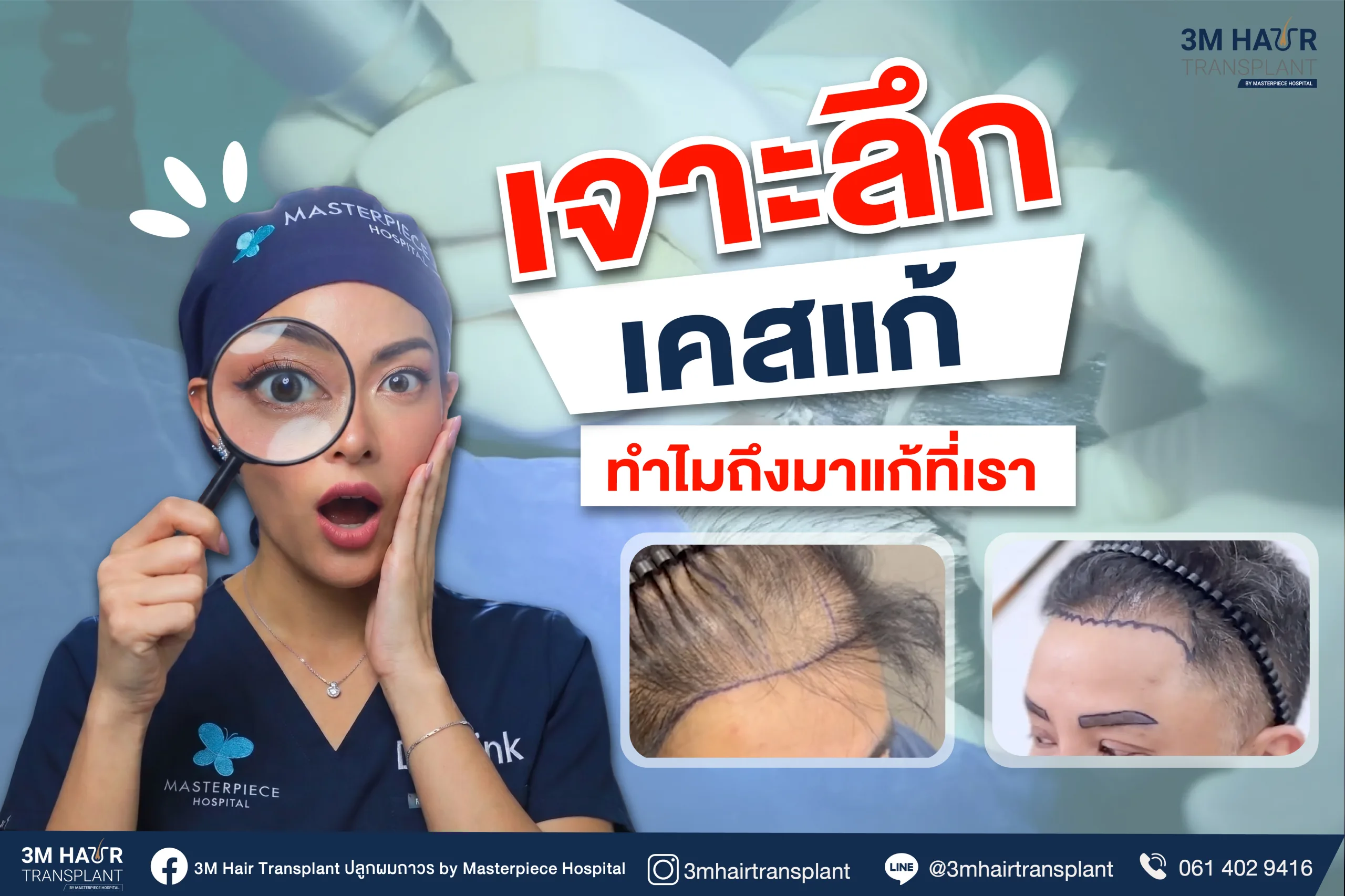เจาะลึก "เคสแก้ปลูกผม" มีกี่แบบ พร้อมวิธีซ่อมให้จบในครั้งเดียว