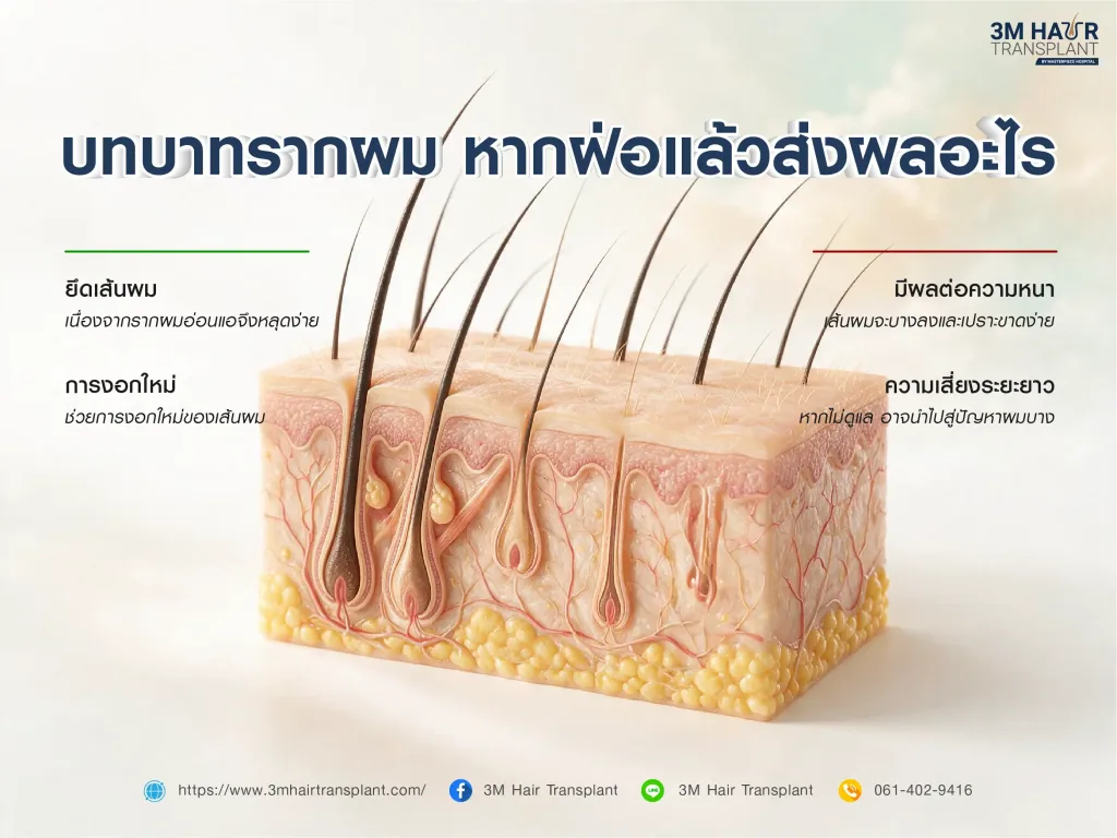 รากผมมีบทบาทอย่างไร ถ้าฝ่อ ไม่แข็งแรง ส่งผลอะไรบ้าง
